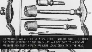 The Most Shocking Old Time Medical Practices