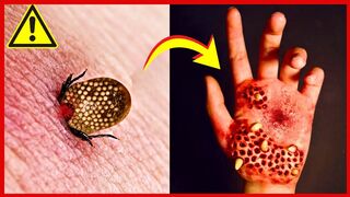 See What The World's Most Dangerous Insect Can Do